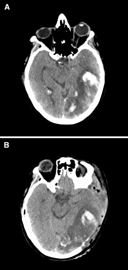 Fig. 1