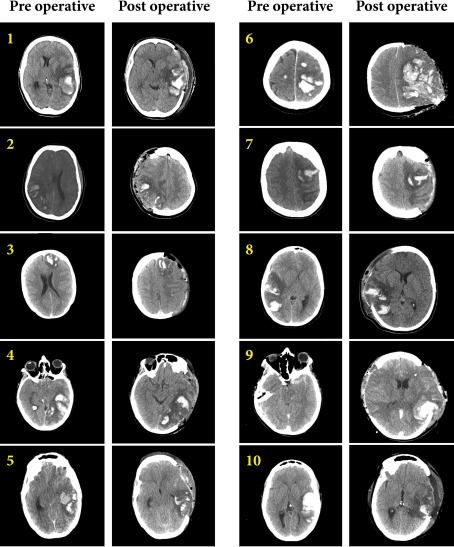 Fig. 2