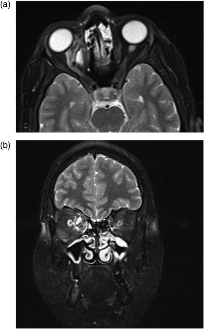 Figure 4: