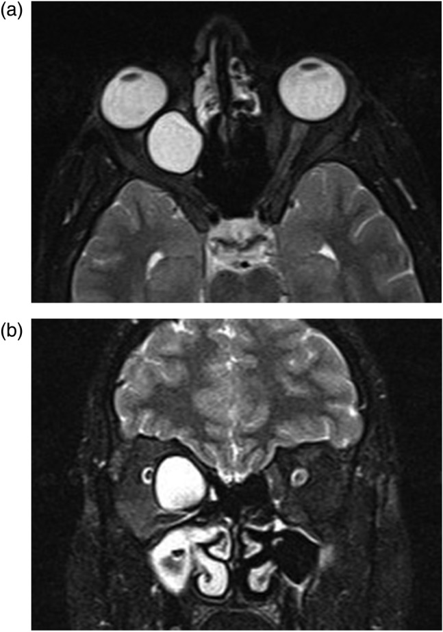 Figure 2: