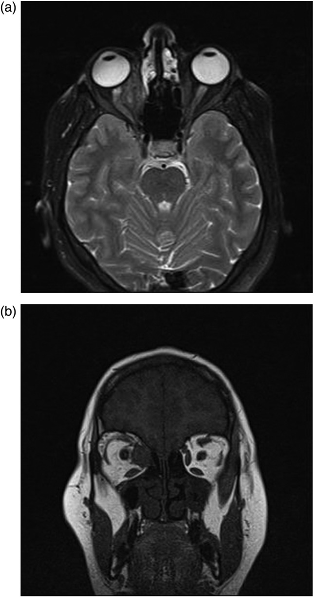 Figure 5: