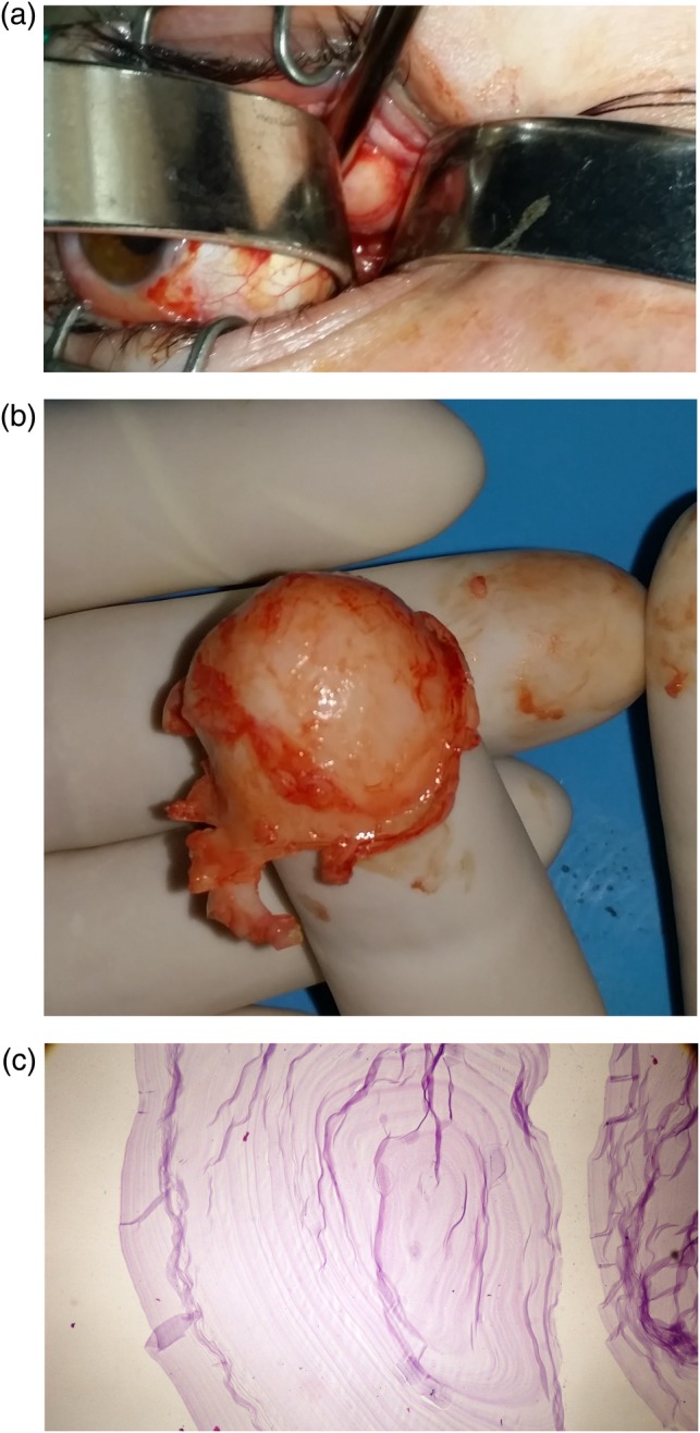 Figure 3: