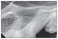 Figure 3cii