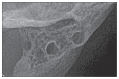 Figure 2d