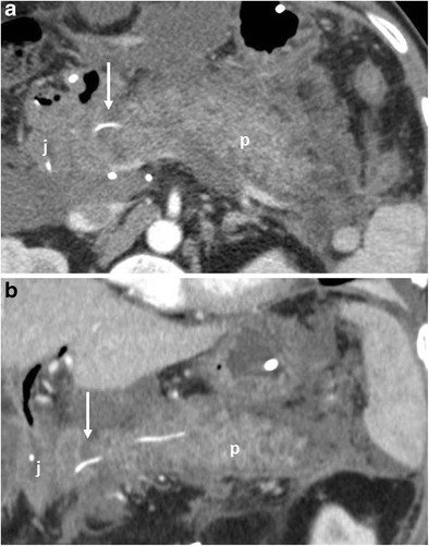 Fig. 21