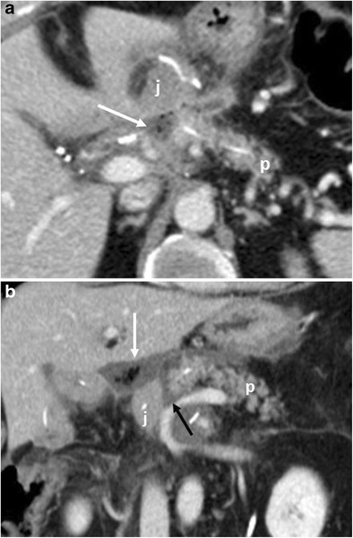 Fig. 14