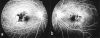 Fig. (4)