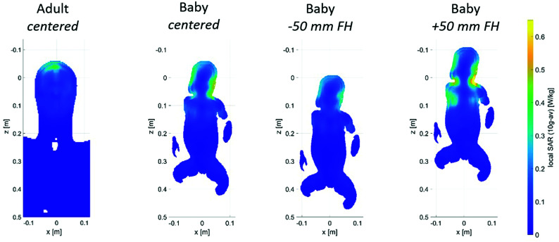 FIG 3.