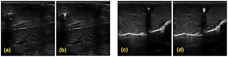 Figure 17