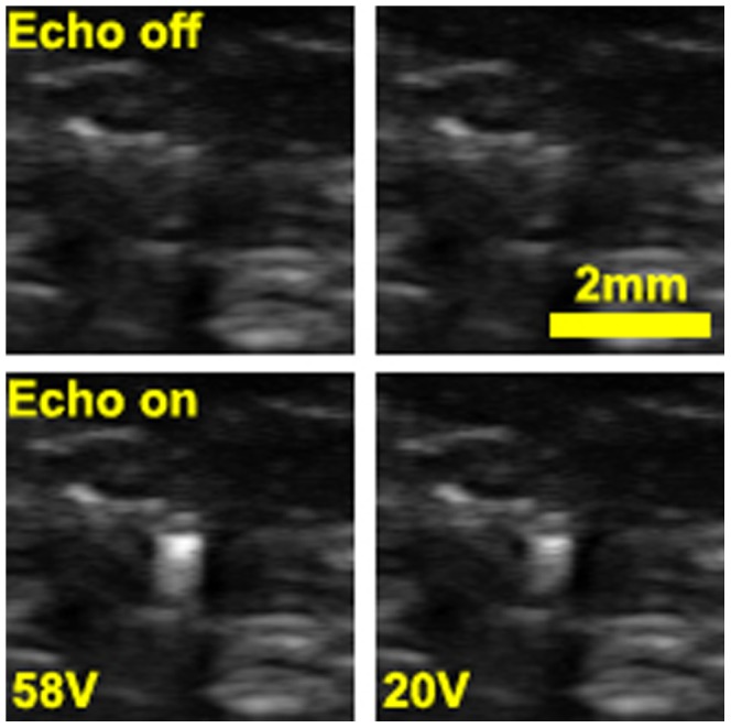 Figure 14