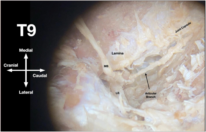 Fig. 2b