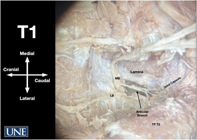 Fig. 2a