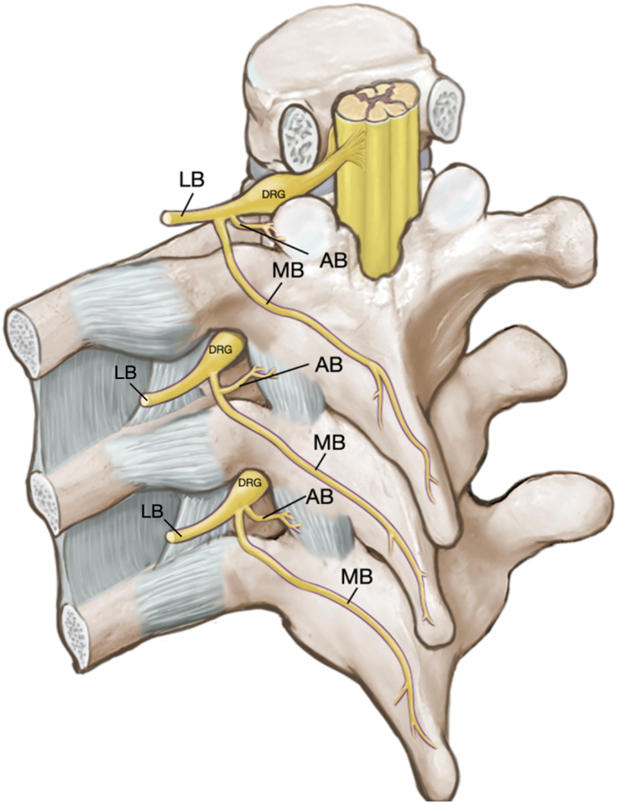 Fig. 1a