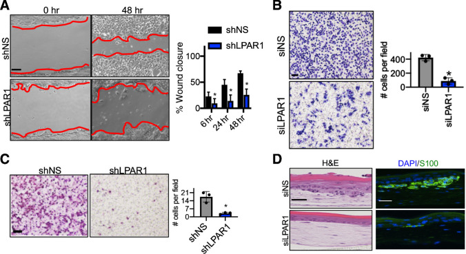 Figure 3. LPAR1 drives melanoma motility and invasiveness. A, A wound healing assay was performed in WM9 cells with the knockdown of LPAR1. Red lines indicate the leading edges of migrating cells. Scale bar, 50 μm. The percentage of wound closure after different time periods of migration was calculated and is shown. Error bars, SD; n = 3; *, P < 0.05. B, Transwell migration assay (without Matrigel coating) was performed for WM9 cells infected with luciferase shRNA (shLuc) or shLPAR1. Scale bar, 100 μm. Right, the number of migrated cells were quantified. Error bars, SD; n = 3; *, P < 0.05. C, Transwell invasion assay (with Matrigel coating) was performed in 1205Lu cells infected with shLuc or shLPAR1. Scale bar, 100 μm. The numbers of invaded cells were quantified. Error bars, SD; n = 3; *, P < 0.05. D, 1205Lu cells transfected with siNS or siLPAR1 were used to make skin reconstructs. S100, green; DAPI, blue. Scale bar for hematoxylin and eosin (H&E) staining, 50 μm. Scale bar for immunofluorescence staining, 20 μm.