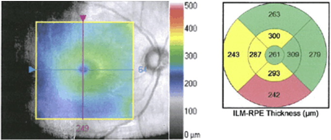 Fig. 1