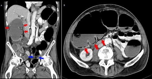 Figure 4A and B.