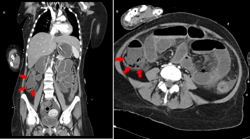 Figure 1A and B.