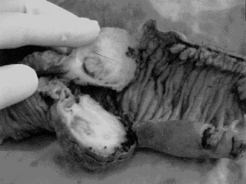 graphic file with name 11FF4.jpg