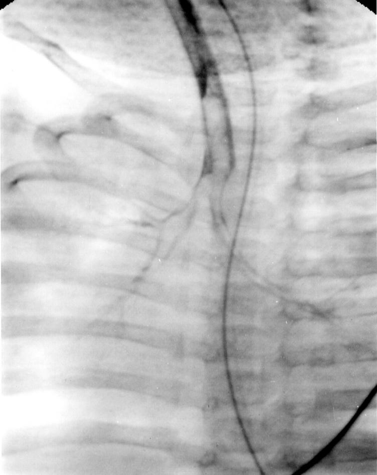 Figure 2  