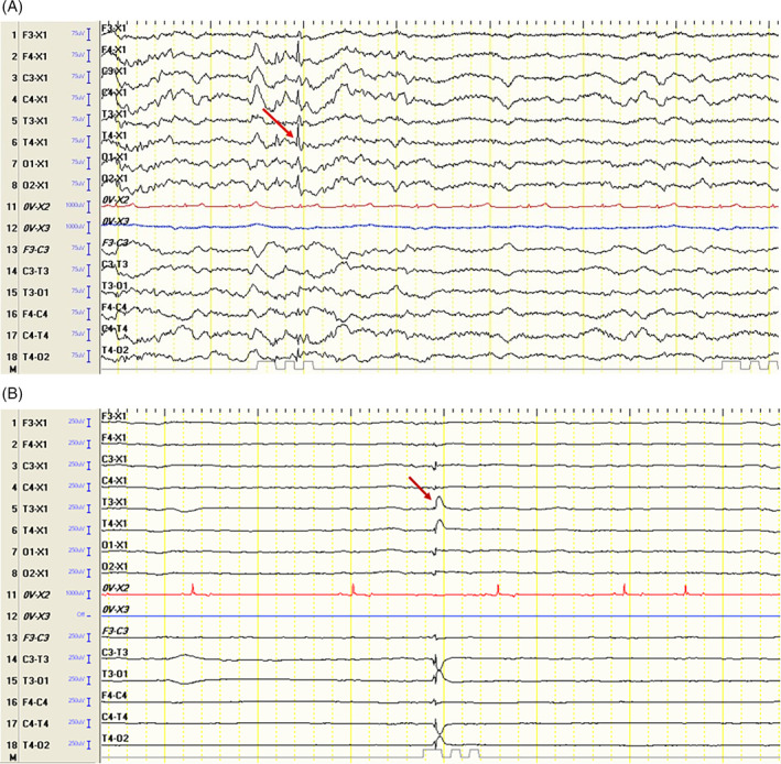 FIGURE 3