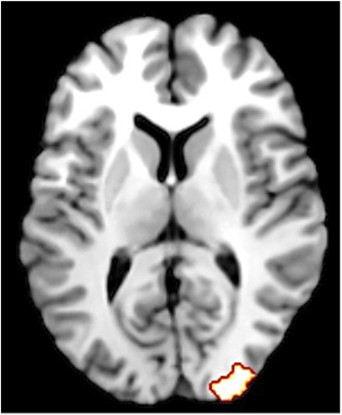 FIGURE 4