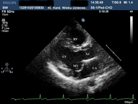 Fig. 1