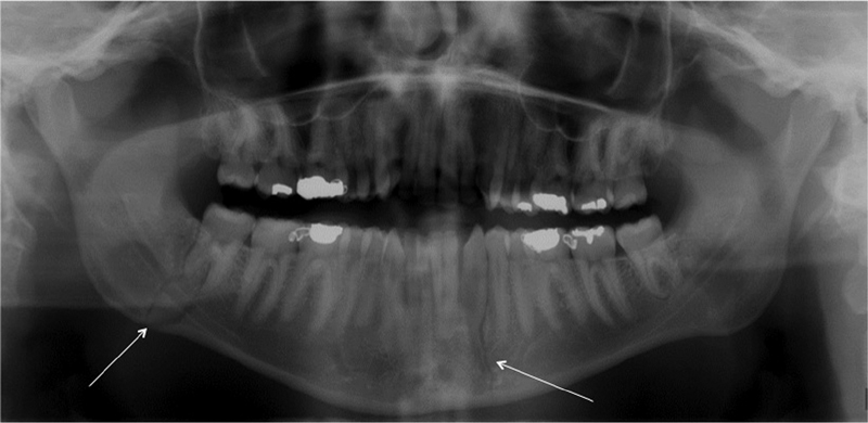 Fig. 7