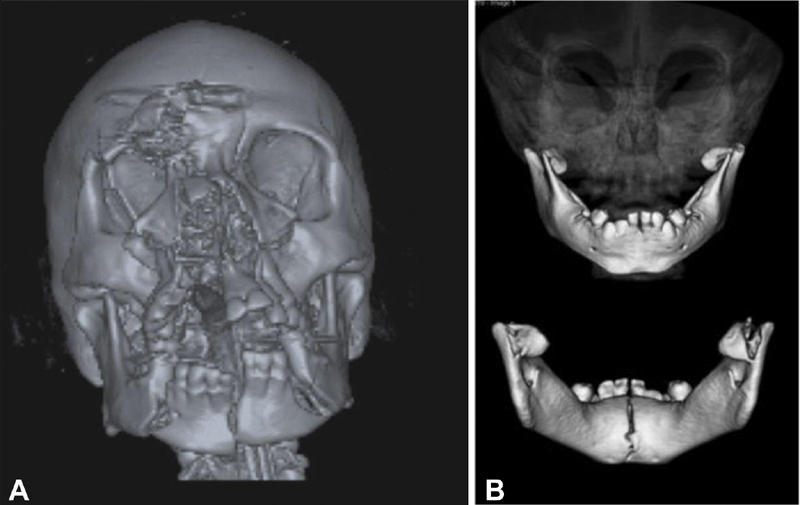 Fig. 8