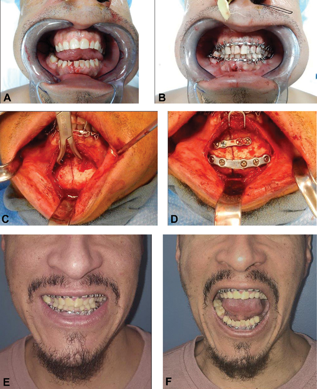 Fig. 13