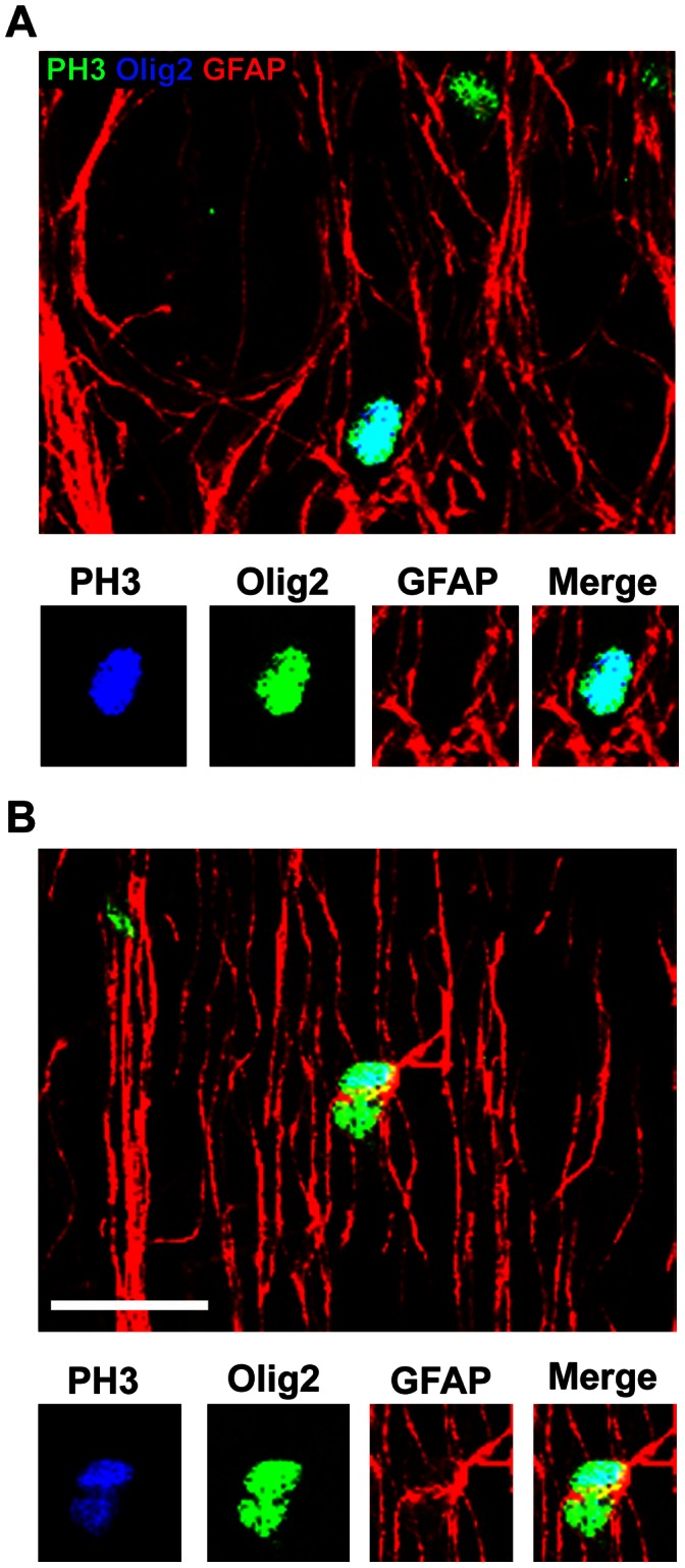 Figure 14
