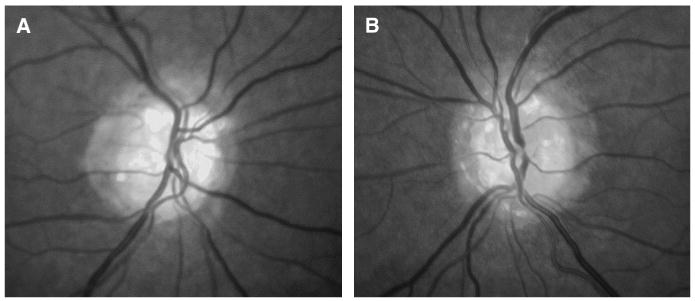 FIG. 1