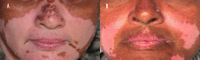 Figure 14.