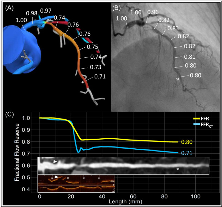 FIGURE 3