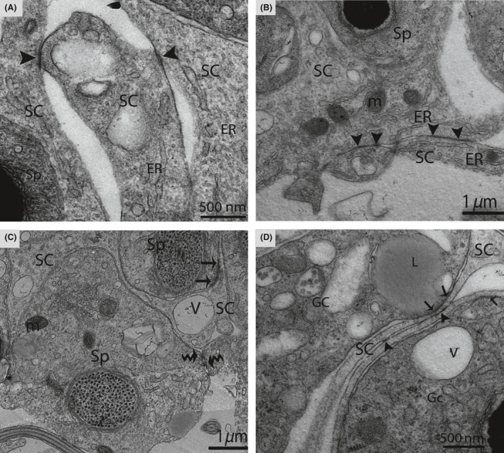 Figure 11