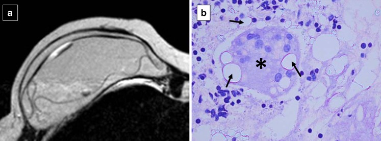 Fig. 22