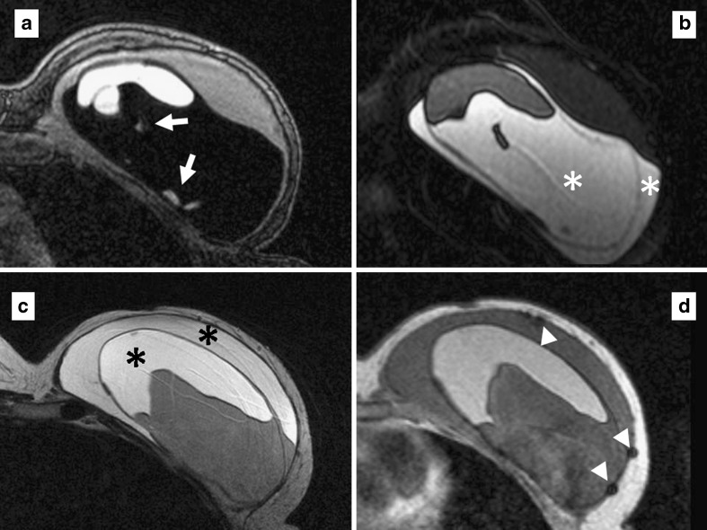 Fig. 12