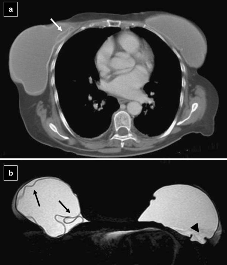 Fig. 24