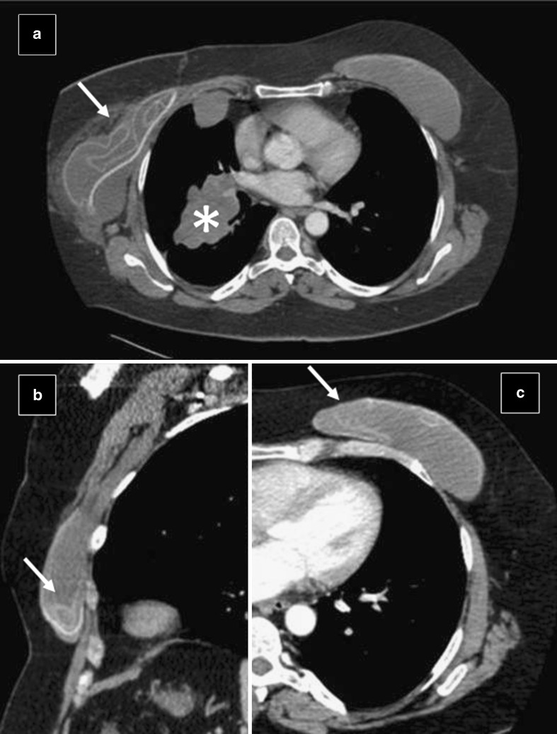 Fig. 23