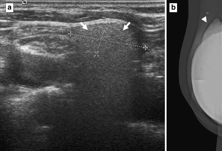 Fig. 21