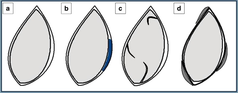 Fig. 13