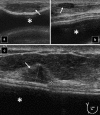 Fig. 25