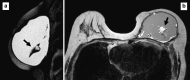 Fig. 11