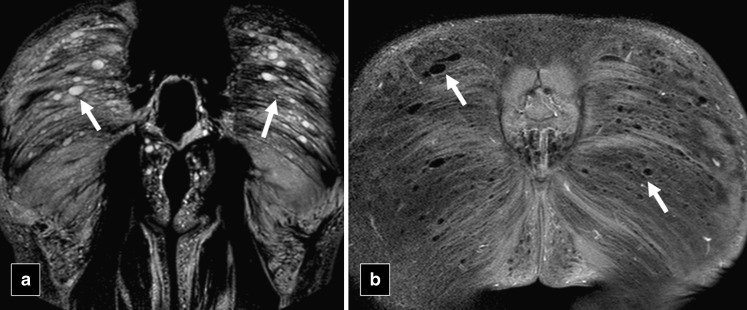 Fig. 20