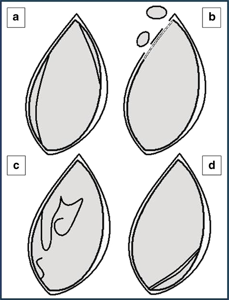 Fig. 15