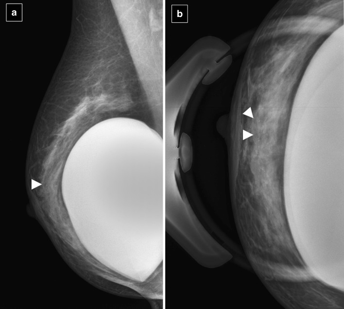 Fig. 26