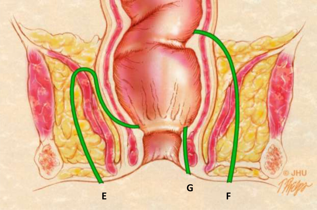 Fig 10