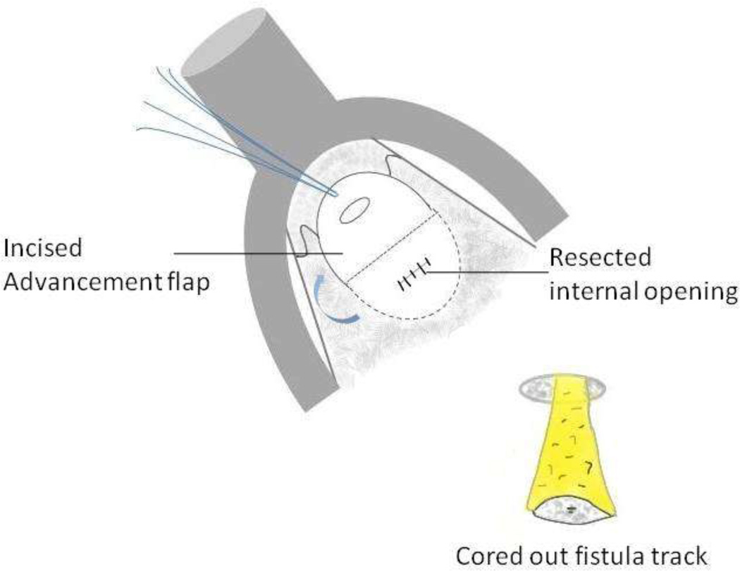 Fig 14