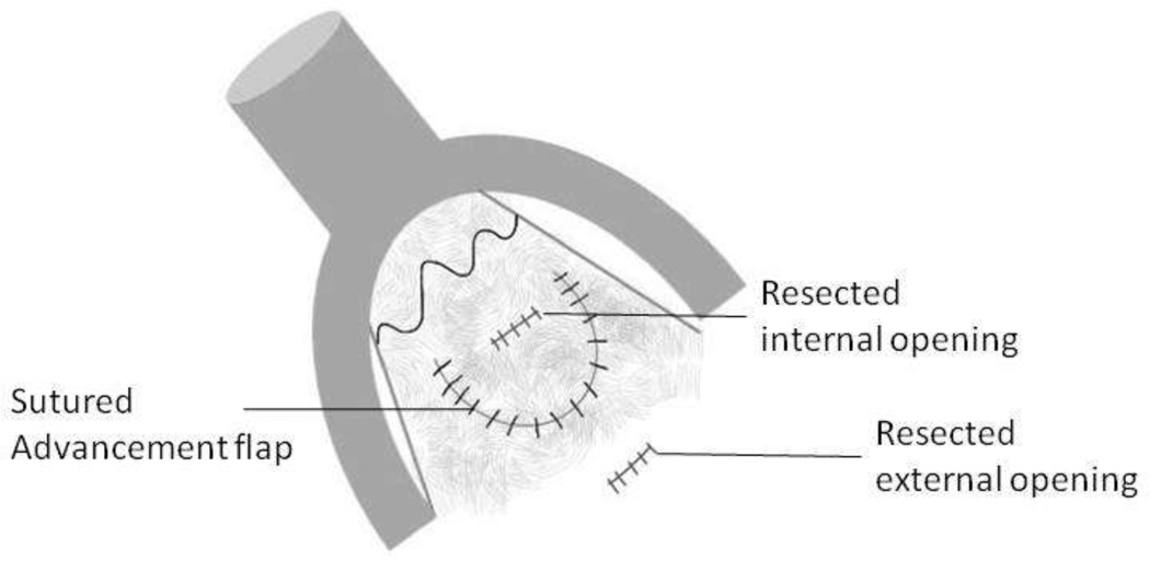 Fig 14