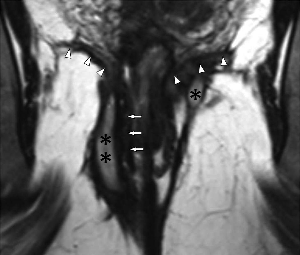 Fig 12