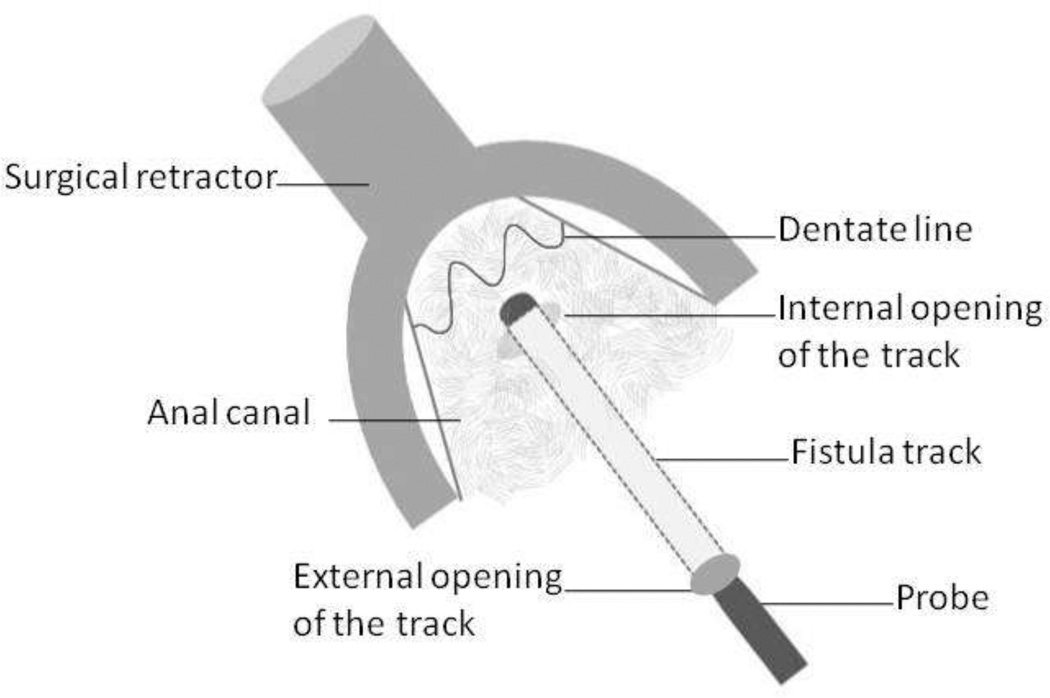 Fig 14